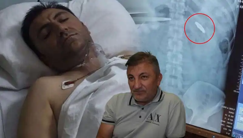 15 Temmuz’un İzleri: Kurşunla Değişen Bir Hayat Hikayesi