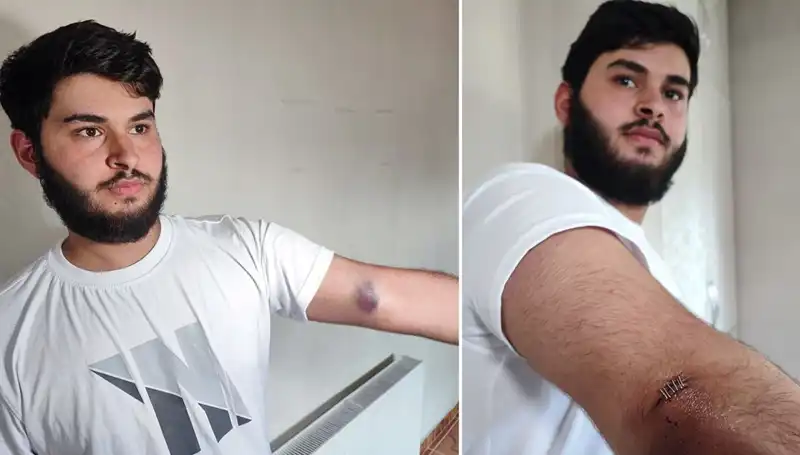 Bahçeye Kaçan Top Mahallede Büyücek Bir Kaosa Neden Oldu